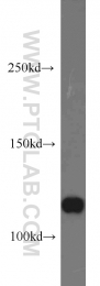 15129-1-AP - ABLIM1