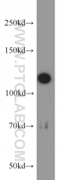 15129-1-AP - ABLIM1
