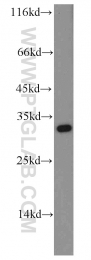 14148-1-AP - ABT1