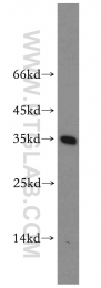 14148-1-AP - ABT1