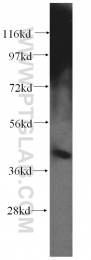 11111-1-AP - ACAA2