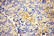 17161-1-AP - ACAD10