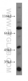 20135-1-AP - ACAP1 / CENTB1