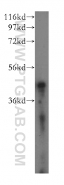 16215-1-AP - ACAT1 / MAT