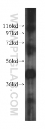 16215-1-AP - ACAT1 / MAT