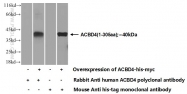 20941-1-AP - ACBD4