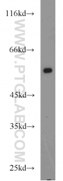 13096-1-AP - Beta-2 adrenergic receptor
