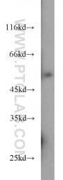 13096-1-AP - Beta-2 adrenergic receptor