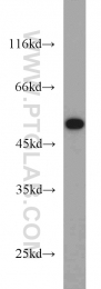 13096-1-AP - Beta-2 adrenergic receptor
