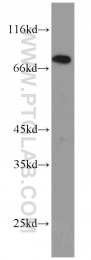 13990-1-AP - Beta-ARK-1 / ADRBK1