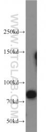 13990-1-AP - Beta-ARK-1 / ADRBK1