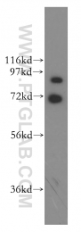 13727-1-AP - Beta-ARK-2 / ADRBK2