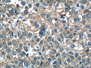 25167-1-AP - ALDH1A3 / ALDH6