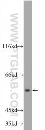 25167-1-AP - ALDH1A3 / ALDH6