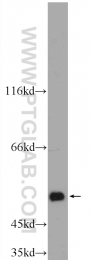 25167-1-AP - ALDH1A3 / ALDH6