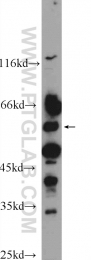 25167-1-AP - ALDH1A3 / ALDH6
