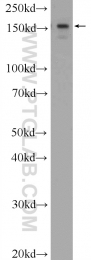 23894-1-AP - ATAD2