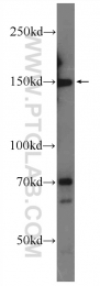 24954-1-AP - ATAD5