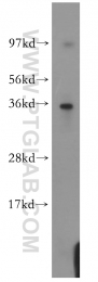 11946-1-AP - ATF1