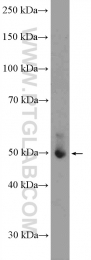 10835-1-AP - ATF4