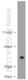 10835-1-AP - ATF4