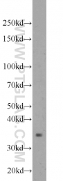 10835-1-AP - ATF4