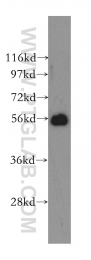 12149-1-AP - Atlastin-1 / SPG3A