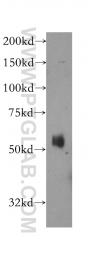 12149-1-AP - Atlastin-1 / SPG3A