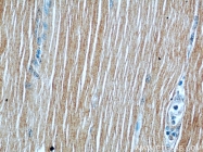 55179-1-AP - ATP1A2
