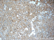 22338-1-AP - ATP1B2