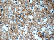 22338-1-AP - ATP1B2