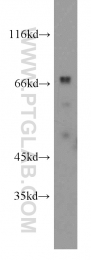 22338-1-AP - ATP1B2