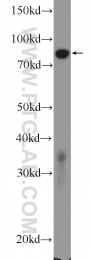 18692-1-AP - ATP4B