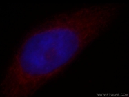 14676-1-AP - ATP synthase subunit alpha
