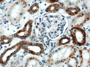 14676-1-AP - ATP synthase subunit alpha