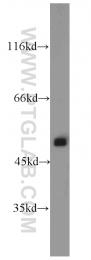 14676-1-AP - ATP synthase subunit alpha