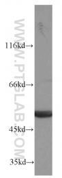 14676-1-AP - ATP synthase subunit alpha