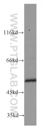 14676-1-AP - ATP synthase subunit alpha