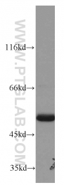 14676-1-AP - ATP synthase subunit alpha