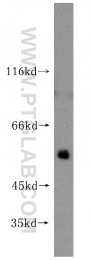 14676-1-AP - ATP synthase subunit alpha