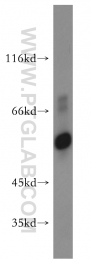 14676-1-AP - ATP synthase subunit alpha