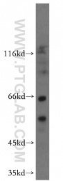 14676-1-AP - ATP synthase subunit alpha