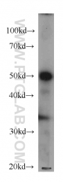 66037-1-Ig - ATP synthase subunit alpha