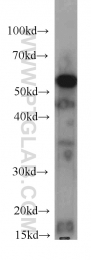 66037-1-Ig - ATP synthase subunit alpha