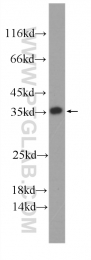 60284-1-Ig - ATP synthase subunit gamma