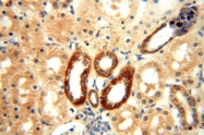 15999-1-AP - ATP5F1