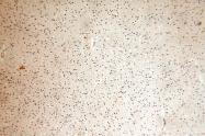 15999-1-AP - ATP5F1