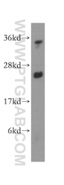 15999-1-AP - ATP5F1
