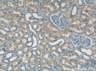 15305-1-AP - ATP6AP1