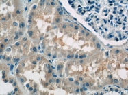 15305-1-AP - ATP6AP1